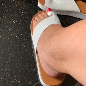 Received bunion sandals by customer S***a