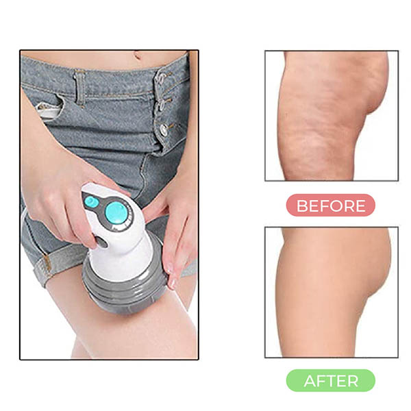 Cellulite Removal Massage Machine
